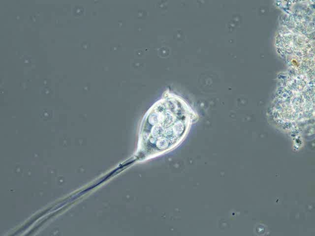 Stalk-ciliate-vorticella