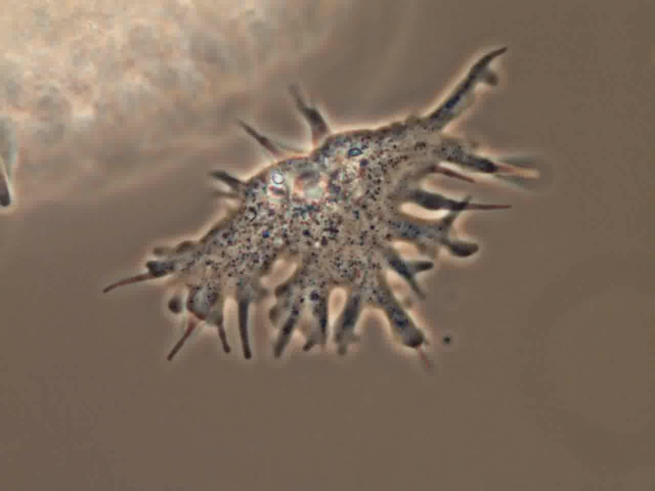 amoeba-korotnevella-thumbnail
