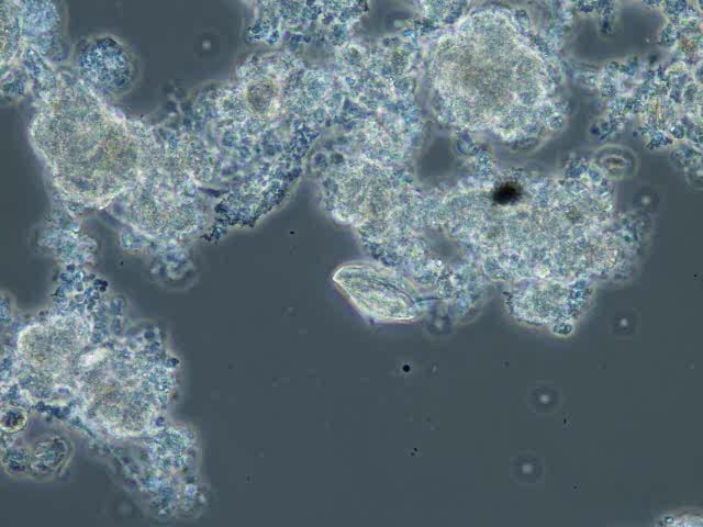 crawling-ciliate-aspidisca