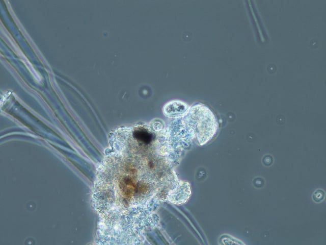 crawling-ciliates