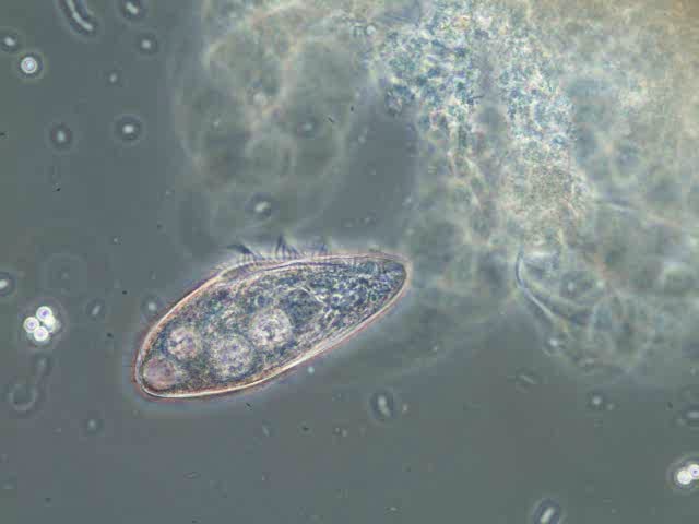 free-swimming-ciliate-acineria