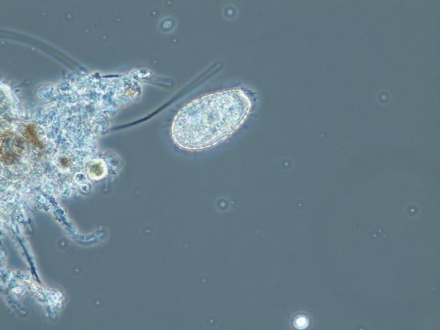 free-swimming-ciliate-cyclidium
