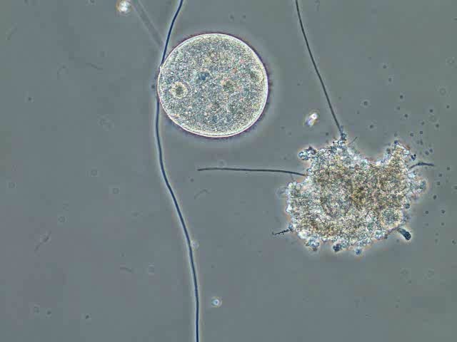 free-swimming-ciliate-glaucoma