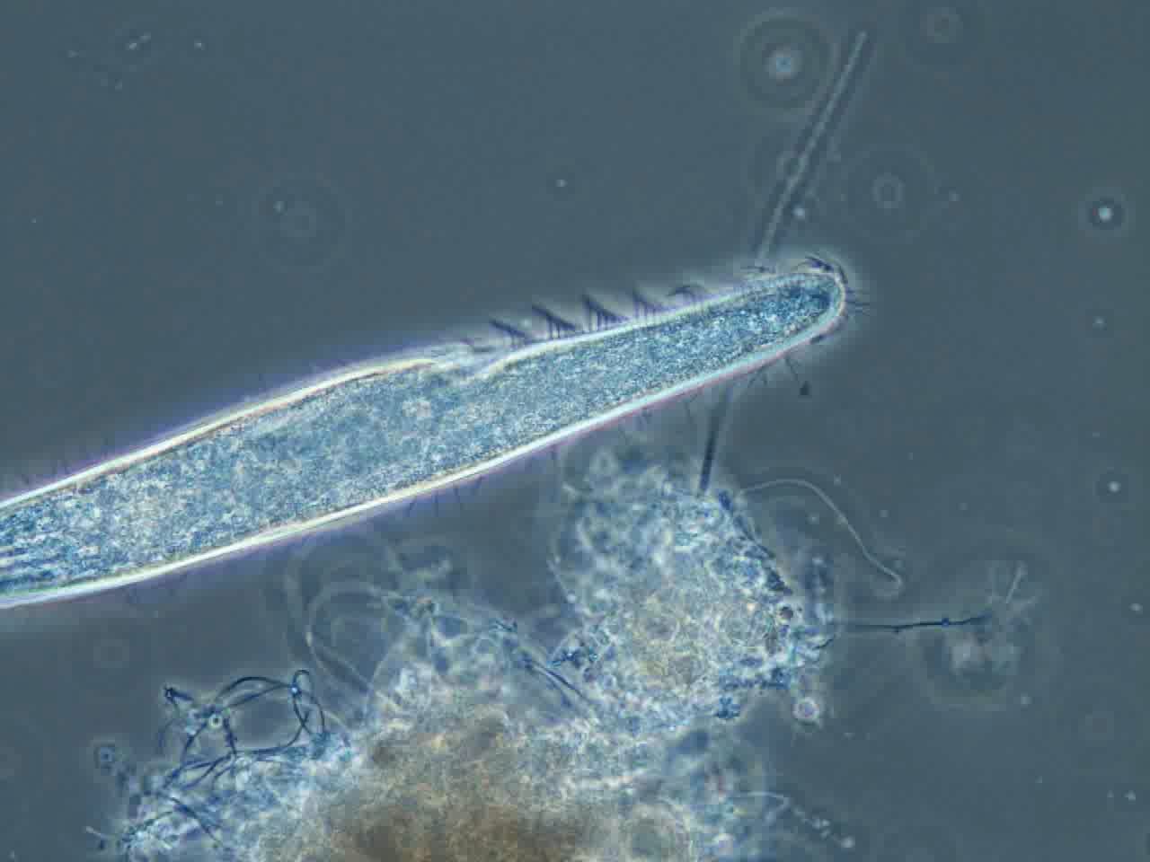 free-swimming-ciliate-spirstomum