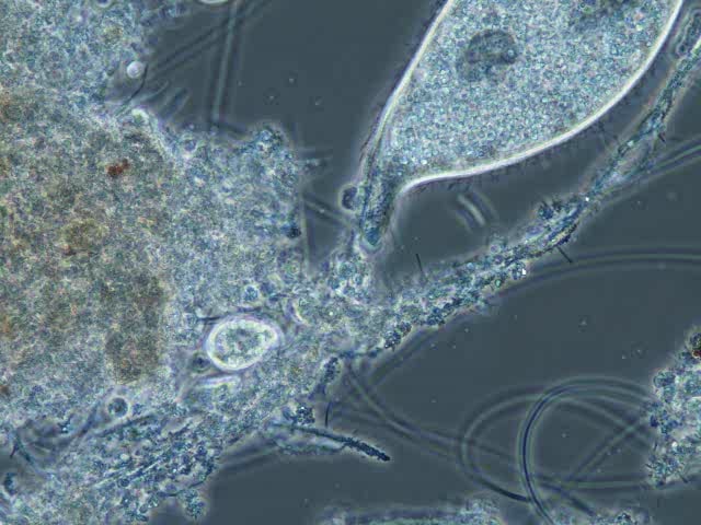 free-swimming-ciliate-tetrahymena