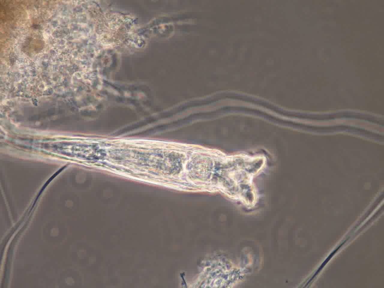 rotifer