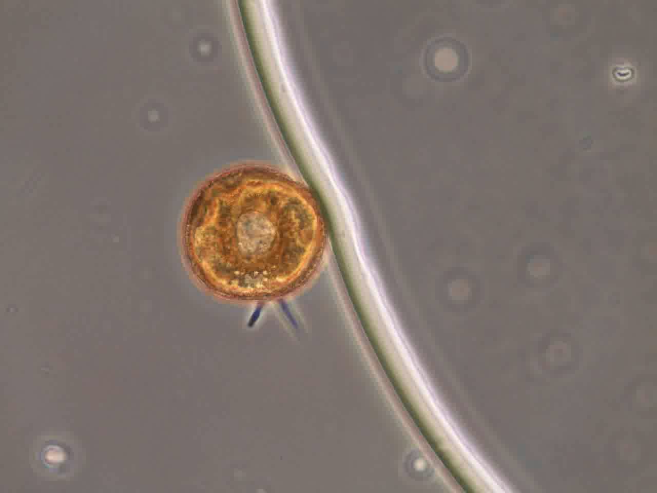 shelled-amoeba-arcella