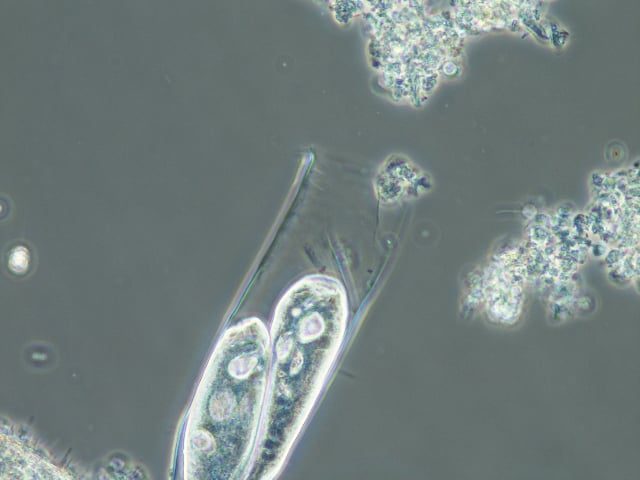 vaginacola