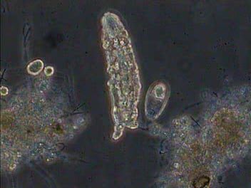 waterbear